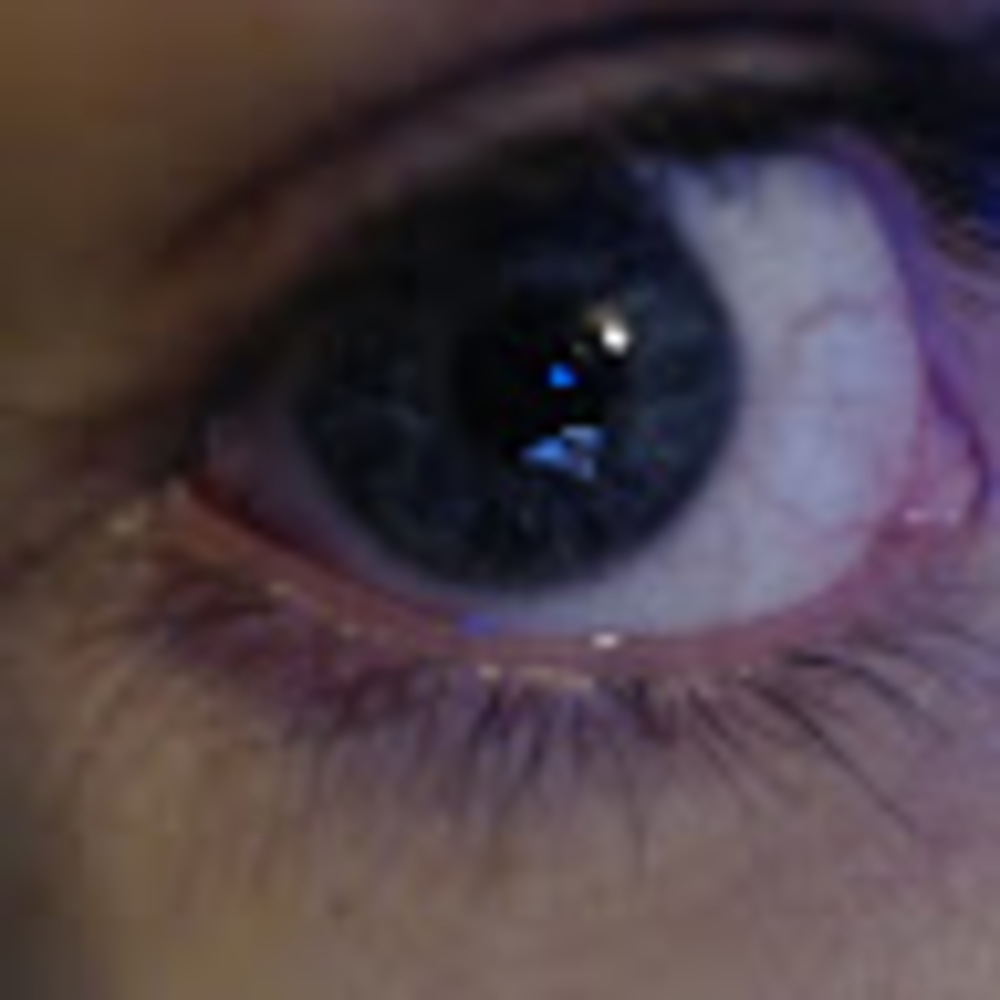 Meet your Posher, Kleinfelt